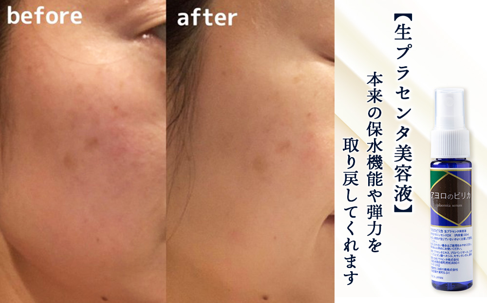 【12月20日決済確定分まで年内発送】北海道白老産 生プラセンタ美容液＆北海道産 サプリメント ～アヨロのピリカ・アンケシ～