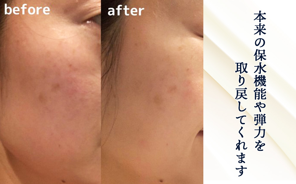 【定期便・全3回】北海道白老産 生プラセンタ美容液 ～アヨロのピリカ～