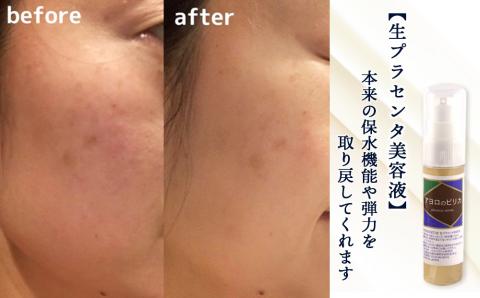 【定期便・全6回】北海道白老産 生プラセンタ美容液＆サプリメント ～アヨロのピリカ × アンケシ～