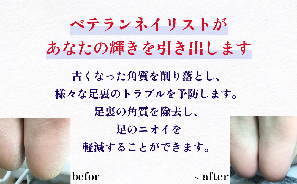 足裏 角質取り 体験 チケット 角質 ケア 足 予防 ニオイ 軽