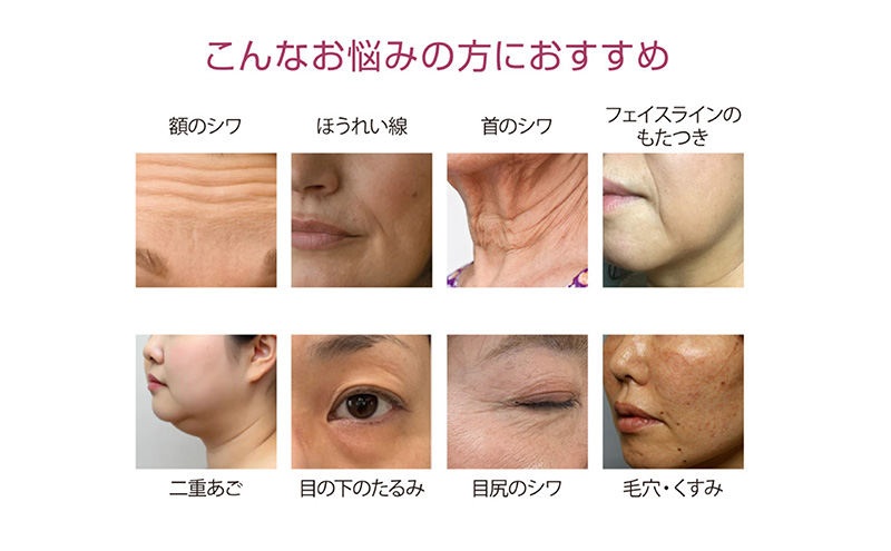 ミニキュアエクセレント(R) ラジオフォトレーション 美容 美肌