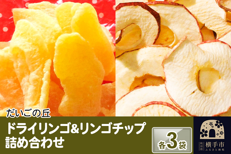 ドライリンゴ、りんごチップス詰め合わせ