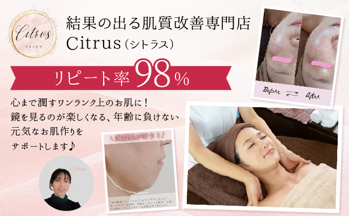 しわ改善コース（陶肌トリートメント＋CYリキッド）とヘッドマッサージ　385P8402