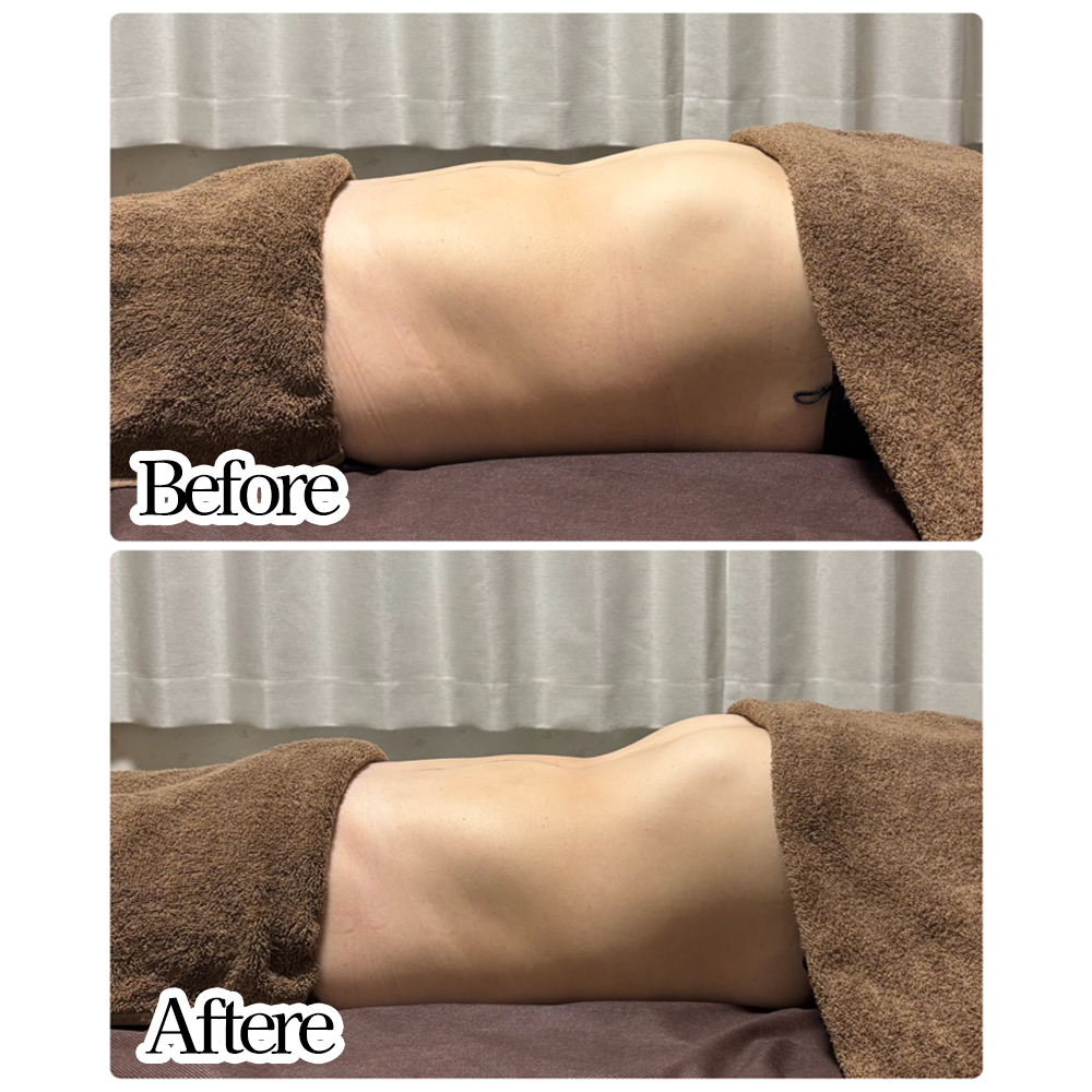 究極の腸もみ（YOLO式腸もみ×赤岩式）　90分3回コース　【650P8401】