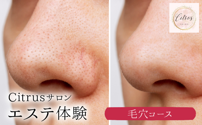 ⽑⽳コース（陶肌トリートメント＋エンザイム）　260P8401