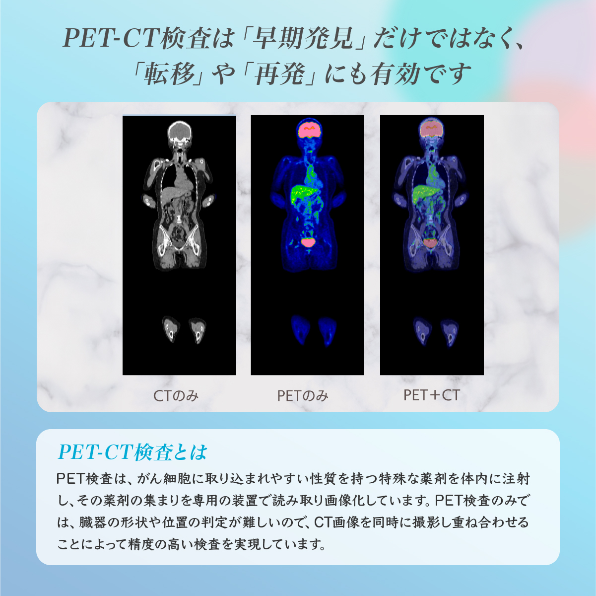 PET-CTプレミアムコース (早期発見のための総合がん検診) チケット 永仁会シーズクリニック