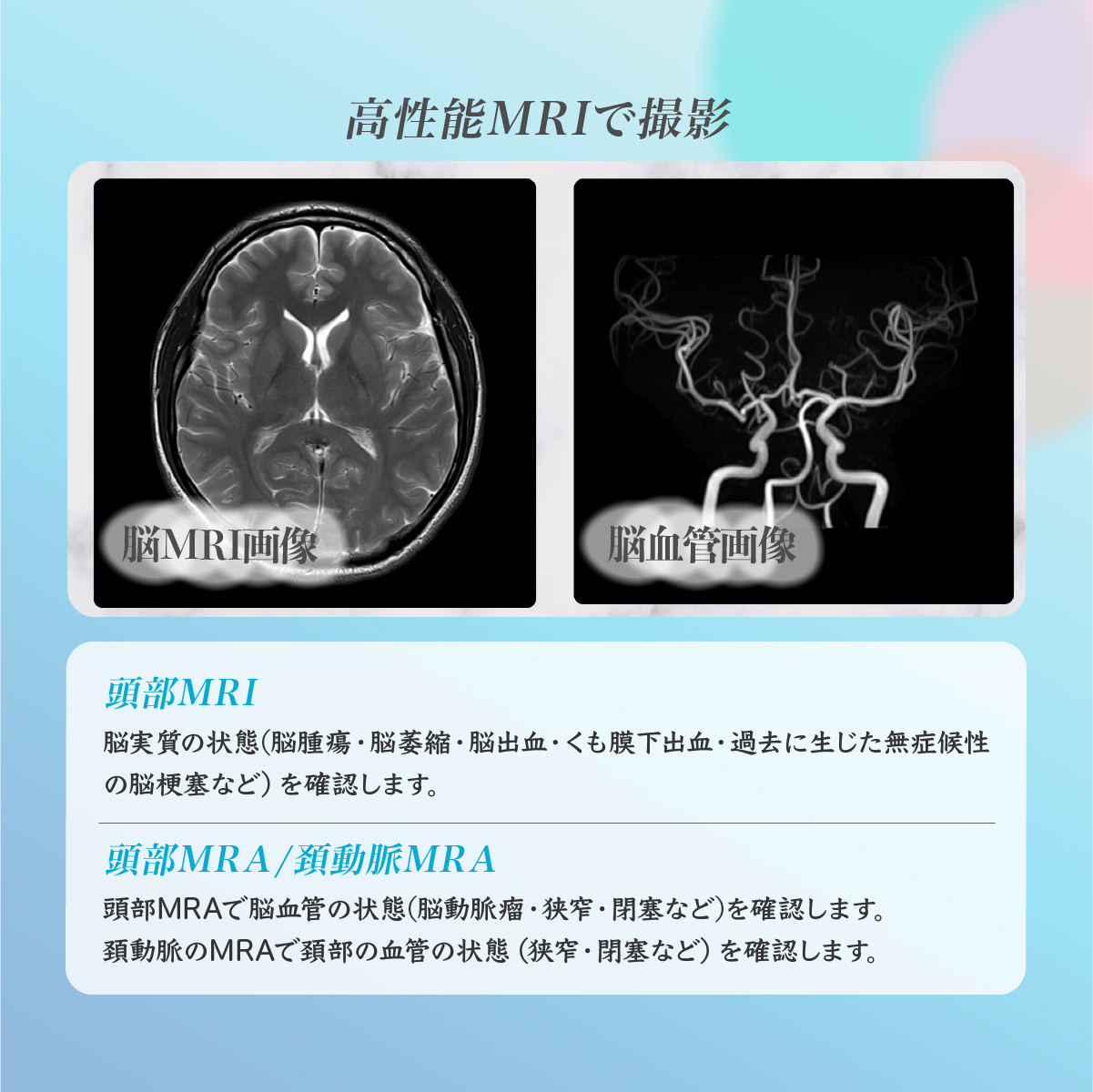 脳ドックバリュー (頭部MRI/MRA検査) チケット 永仁会シーズクリニック