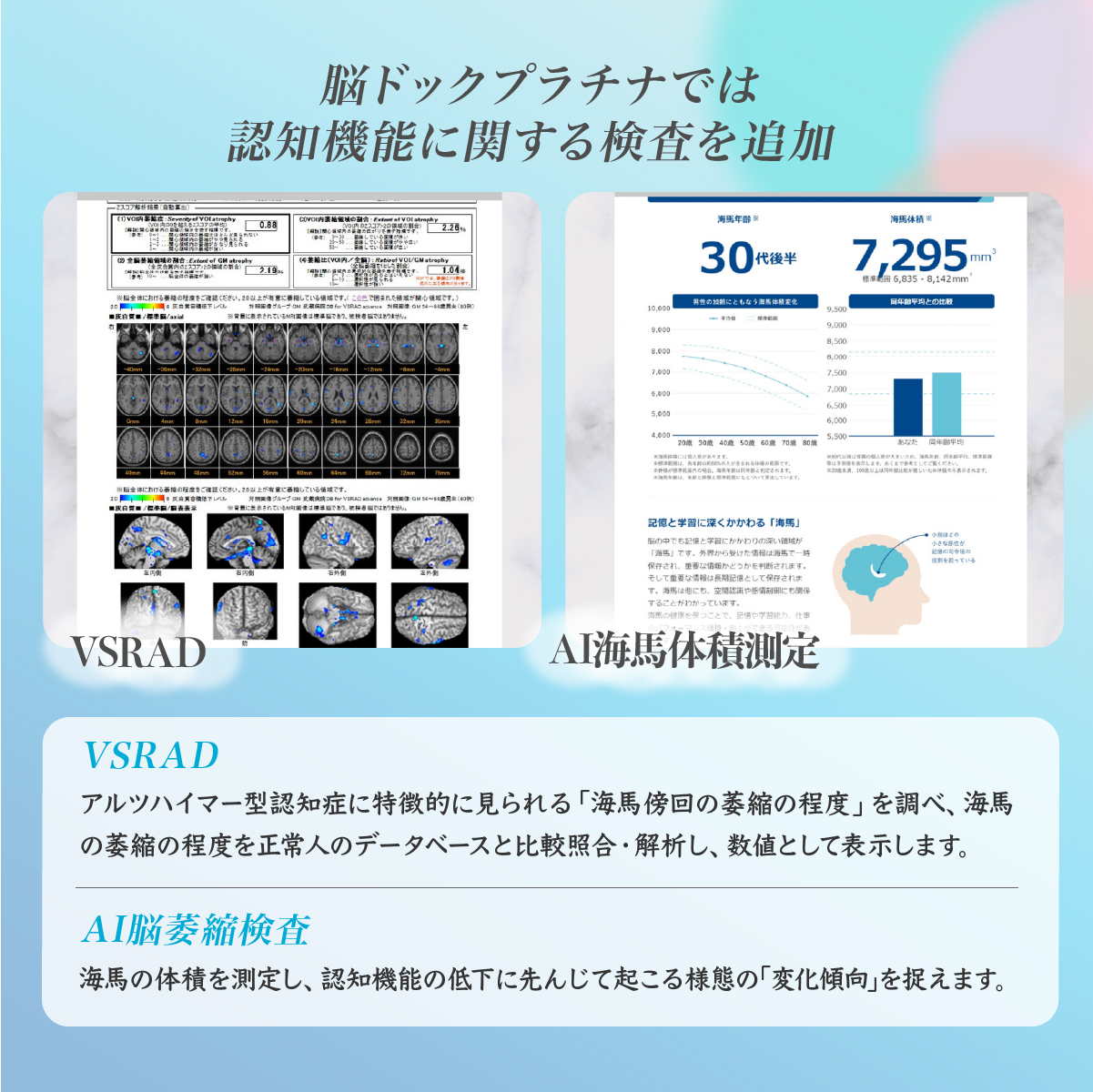 脳ドックバリュー (頭部MRI/MRA検査) チケット 永仁会シーズクリニック