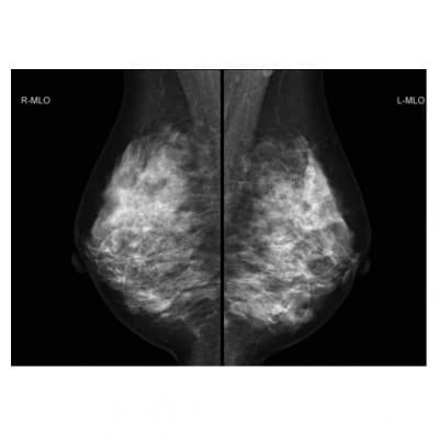 人間ドック(女性のみ)胃カメラ・乳がん検査付