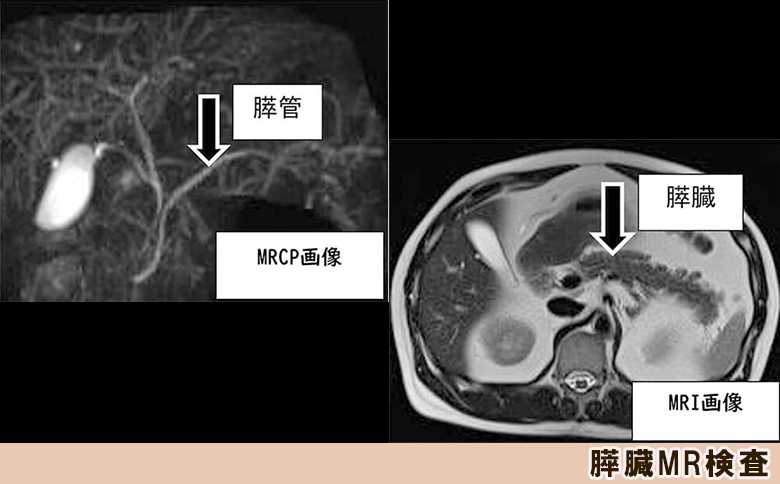【亀田クリニック人間ドック】プレミアムVIP Ｂ（膵臓）コース　１名様（１泊２日）　[0960-0001] プレミアムVIP B《膵臓》（１泊２日）