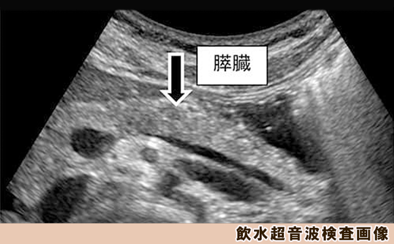 【亀田クリニック人間ドック】プレミアムVIP Ｂ（膵臓）コース　１名様（１泊２日）　[0960-0001] プレミアムVIP B《膵臓》（１泊２日）