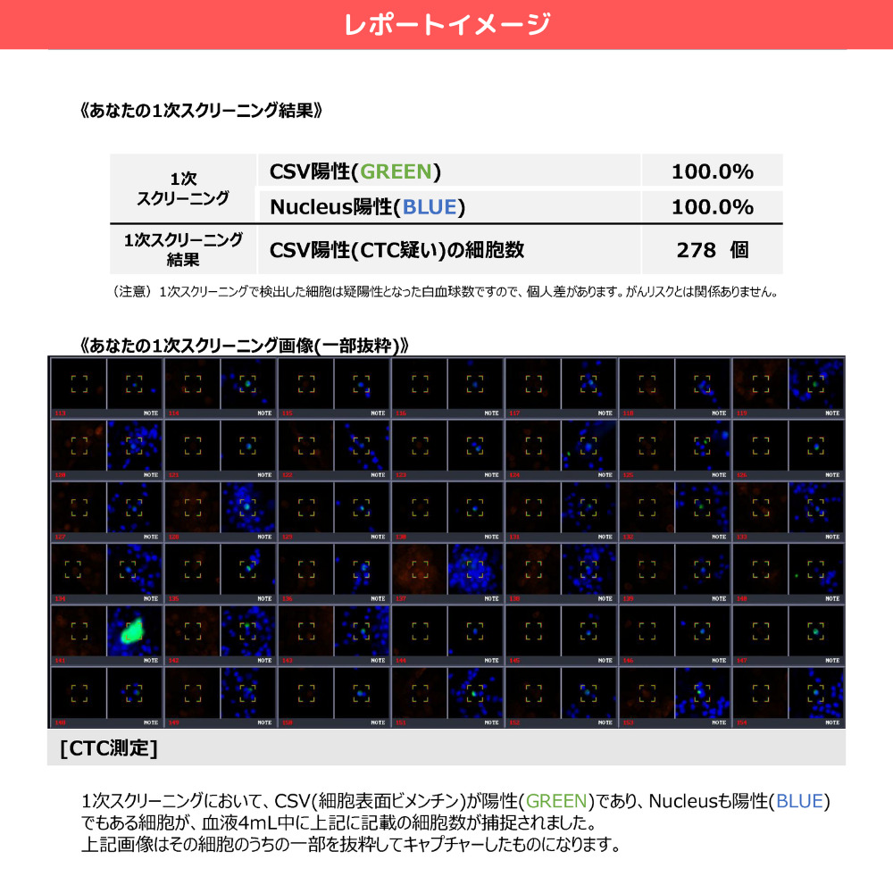 【代々木ウィルクリニック】マイクロCTC検査  【160001】