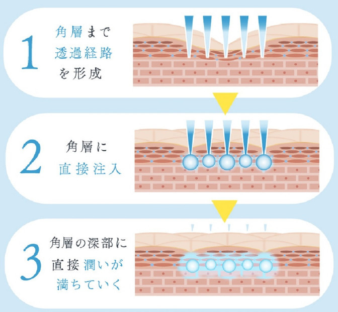 注入できる美容液Seleia（セレイア）Moisture Luxe ST  2本入り