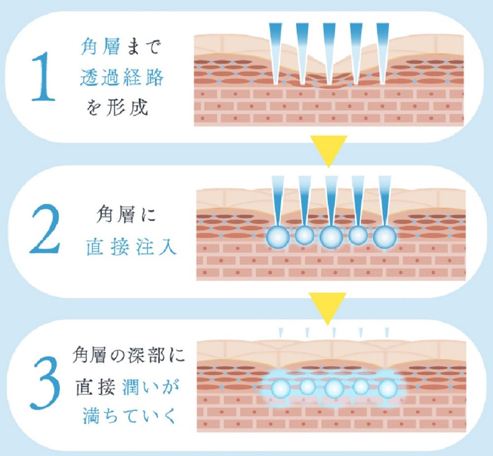 注入できる美容液Seleia（セレイア）Moisture Luxe ST  4本入り