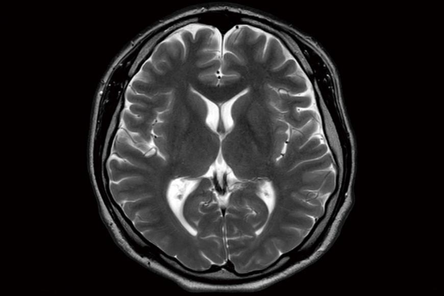 【湘南鎌倉総合病院】健康チェック：脳ドック