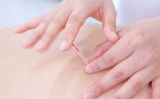 マッサージ券（20分カウンセリング＋90分マッサージ）大聖寺治療院 鍼 整体 マッサージ F6P-2293