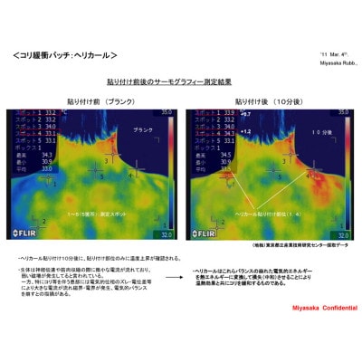 ヘリカールEX　大粒2個入り