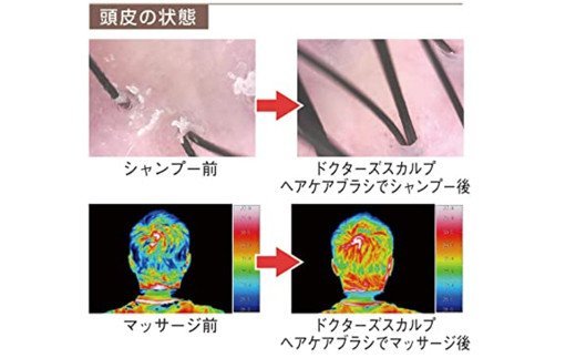 H20-89 ◇貝印 ドクターズスカルプ ヘアケアブラシ（ブラック）KQ1601