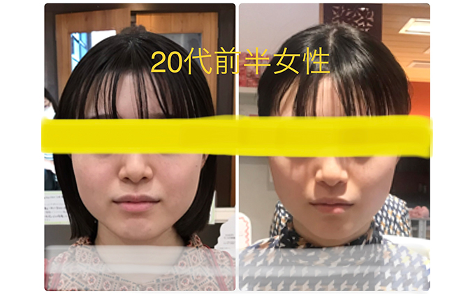 小顔矯正コルギチケット×10回