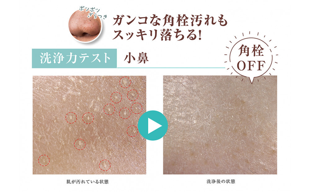 麦飯石のもち泡洗顔　100ｇ×2本