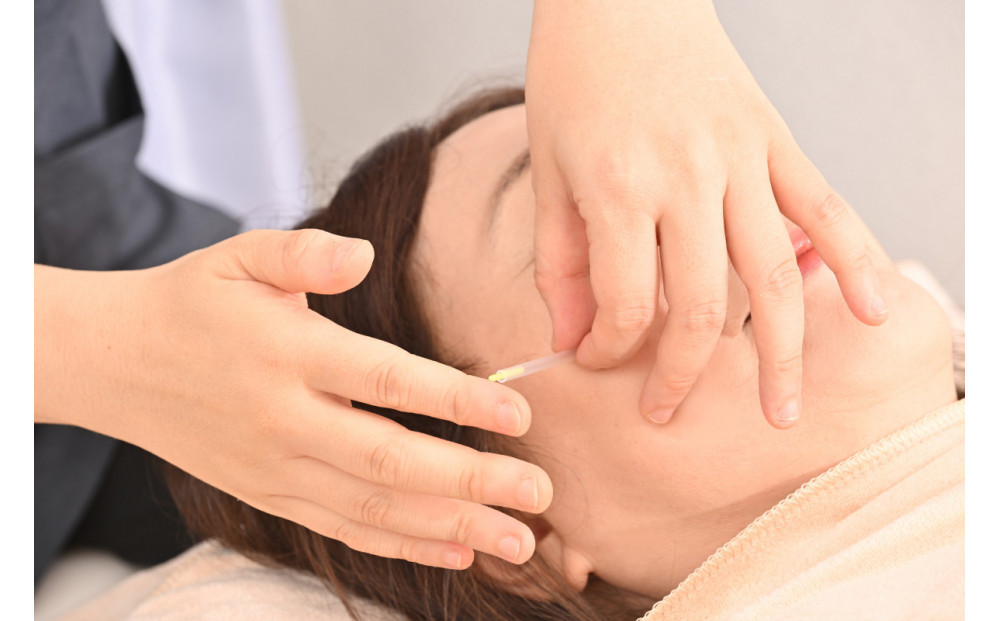 まるごと美容（美容鍼＆美容パック）　