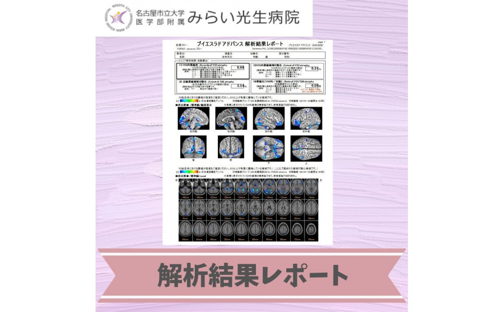 みらい光生病院　Well being(ウェルビーイング)　検診　脳メモリードック