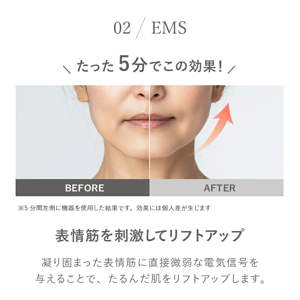 【LOABI/ロアビ公式】 マルチ美顔器 NITENA ニテナ｜美顔器 リフトアップ ほうれい線 ems 目元 たるみ ウォーターピーリング 毛穴ケア LED美顔器 イオン導出 超音波美顔器 しみ 小顔 美容家電 誕生日 プレゼント NITENA ニテナ 愛知県 岐阜県 名古屋 acct LOABI