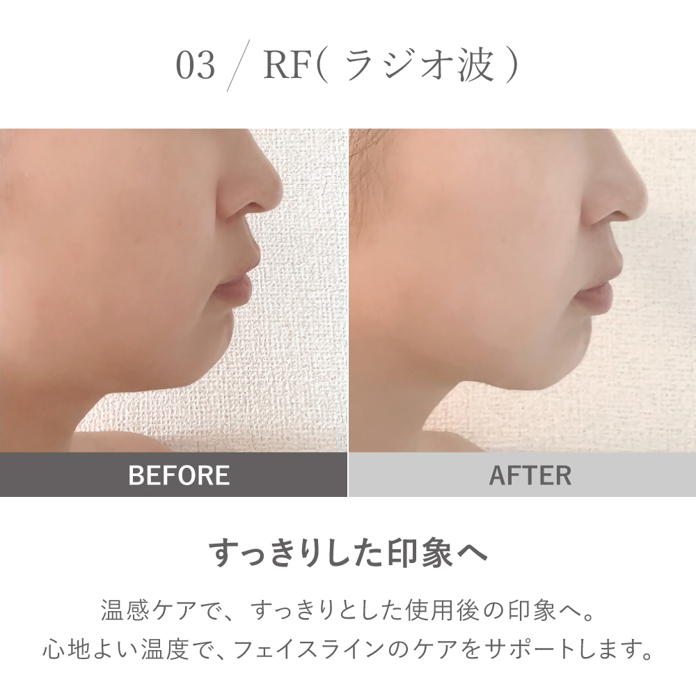 【LOABI/ロアビ公式】 マルチ美顔器 NITENA ニテナ｜美顔器 ems 目元 ウォーターピーリング LED美顔器 イオン導出 美容家電 誕生日 プレゼント NITENA ニテナ 愛知県 岐阜県 名古屋 acct LOABI