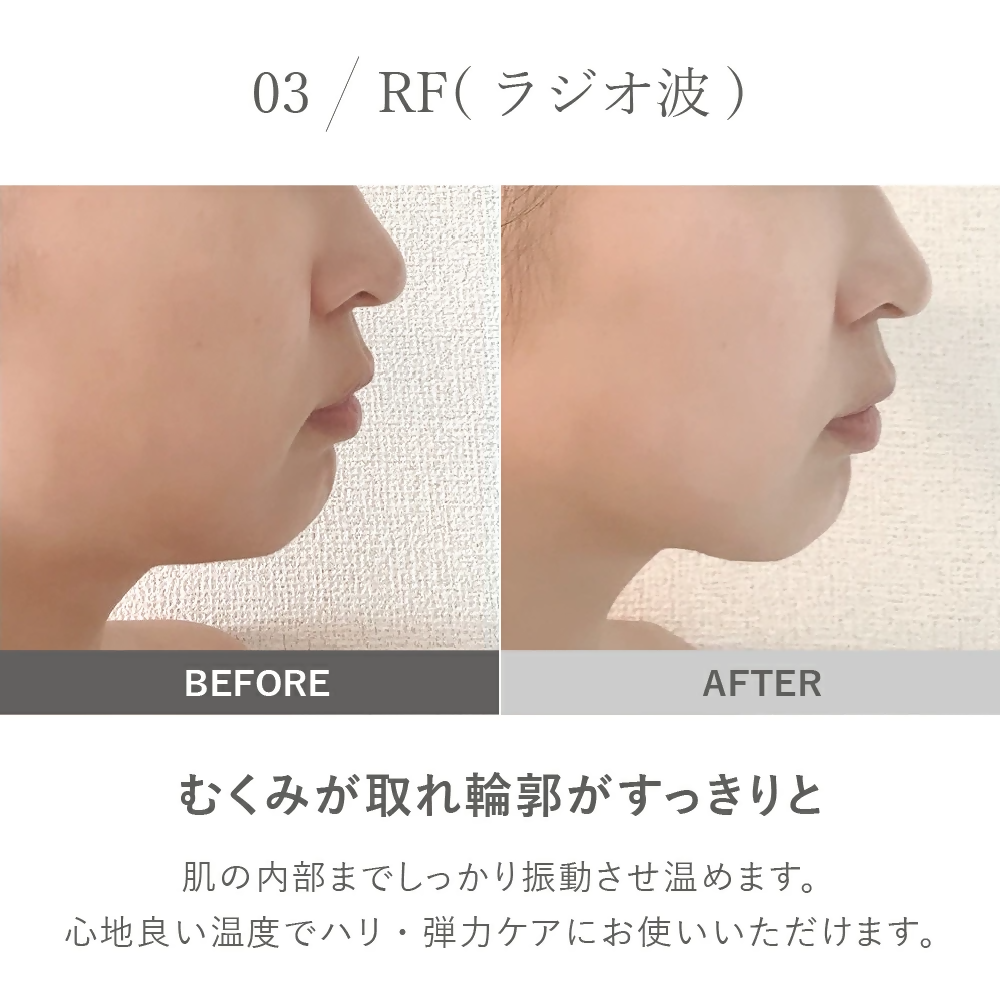 【LOABI/ロアビ公式】 マルチ美顔器 NITENA ニテナ｜美顔器 リフトアップ ほうれい線 ems 目元 たるみ ウォーターピーリング 毛穴ケア LED美顔器 イオン導出 超音波美顔器 しみ 小顔 美容家電 誕生日 プレゼント NITENA ニテナ 愛知県 岐阜県 名古屋 acct LOABI