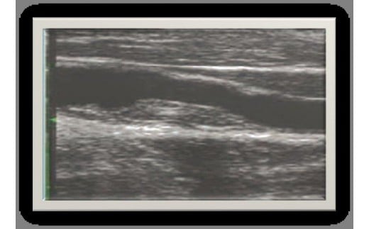 脳ドック 脳ドック