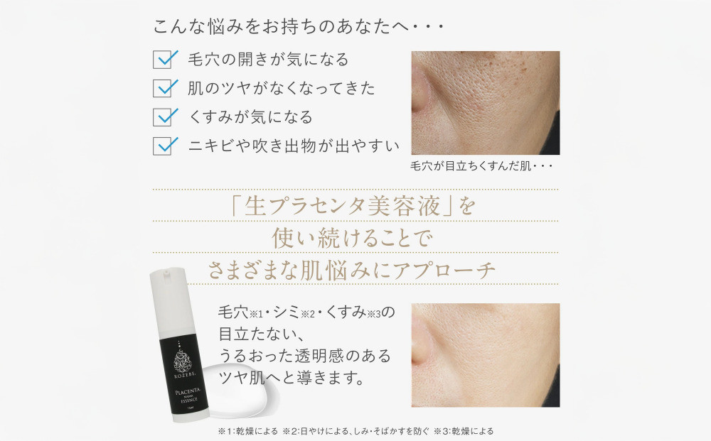【ロゼべ】生プラセンタ 美容液 |京都 コスメ 美容液 人気 おすすめ［ 美容 ブランド 基礎化粧品 スキンケア プラセンタ 生原液  大人のぽっかり毛穴 原液 原液美容液 導入 毛穴 ゆるみ エイジングケア ギフト プレゼント お取り寄せ 通販 送料無料 ふるさと納税 ］