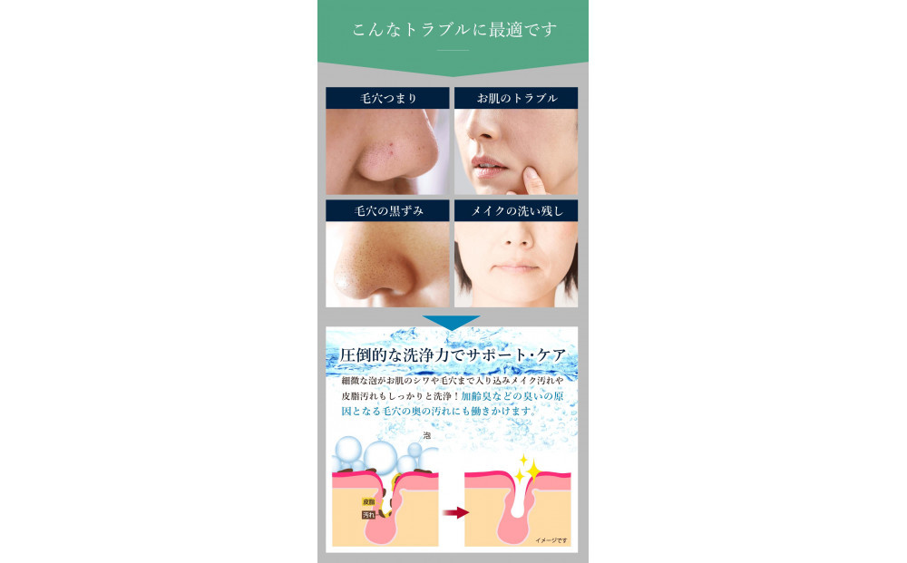 アクアビュルジェネレータ　インライン３　AQUA BULLE