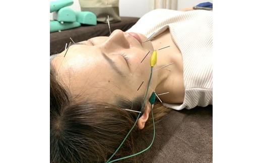 MOHALA鍼灸院美容施術体験チケット（美容鍼等のフェイシャル施術 30分） ※北海道・沖縄・離島への配送不可