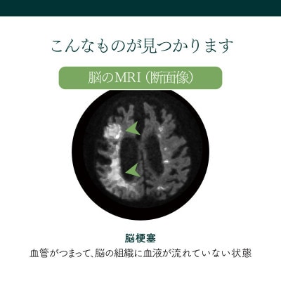 身体の健康診断を受けるなら、脳の状態も知っておいた方がいい!約30分で終わる日帰り脳ドック!