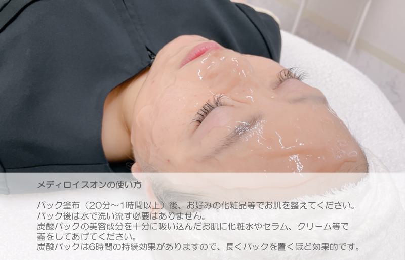 かたまる生炭酸パック メディロイスオン 020C236