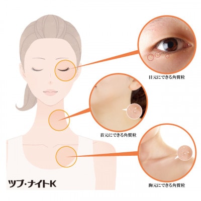 ツブ・ナイトK クリーム 100g　目元などにできるポツポツ(角質粒)のスキンケアに!