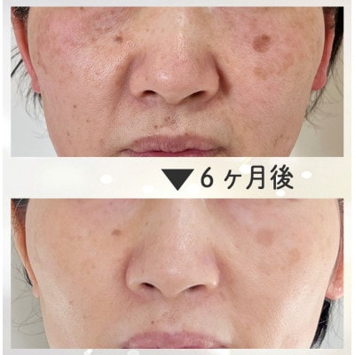 【女性限定】結果にこだわった28年の綺麗になるエステコース(フェイシャルorボディ)