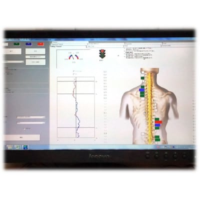 カイロプラクティック施術券(1回分)