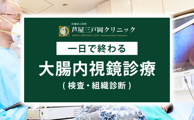 1日で終わる 大腸内視鏡診療 (日帰り) 1名様【芦屋三戸岡クリニック】消化器内視鏡専門クリニック 大腸検査 内視鏡検査 大腸がん 大腸ポリープ などの 早期発見 早期対策 早期治療 健康 カウンセリング [070-a001]