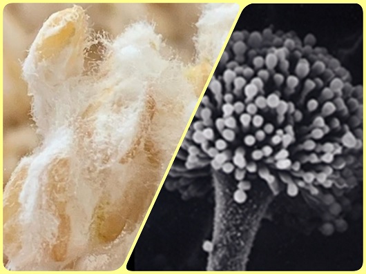 腸活習慣 健康食品アモン 麹のちから 発芽玄米 カルシウム 